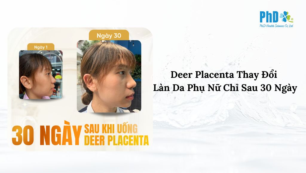 Deer Placenta Đã Thay Đổi Làn Da Phụ Nữ Chỉ Sau 30 Ngày