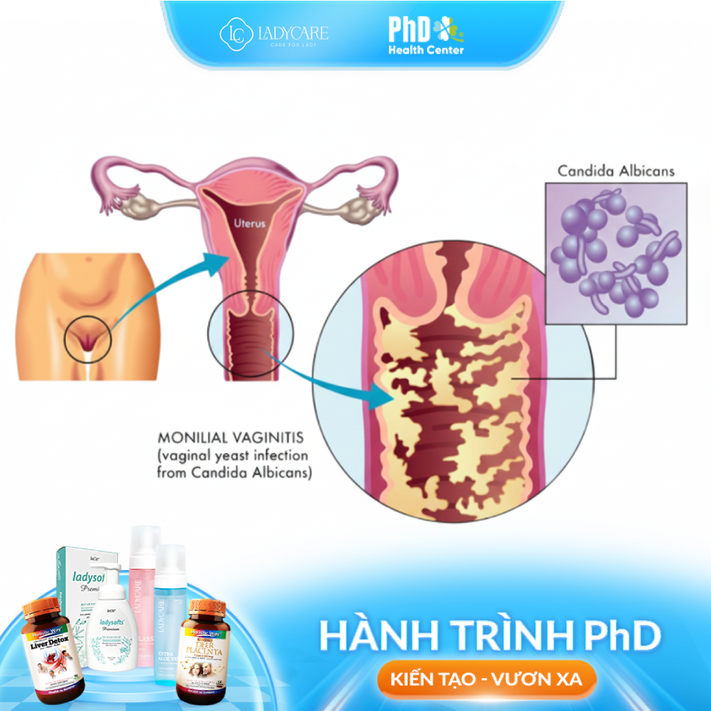 Tác hại của việc vệ sinh âm đạo không đúng cách